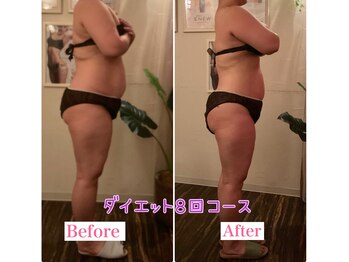 トータルビューティーサロン 凛/服のサイズダウン