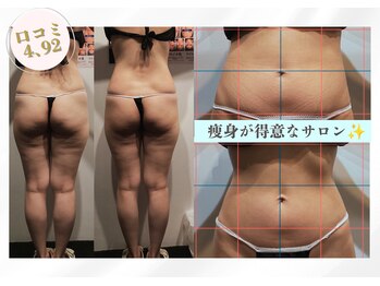 バベルトータルビューティー 北堀江店(Babel Total Beauty)の写真/痩身メニューが高評のサロン!【高技術×低価格】で気になる脂肪へ徹底アプローチ! コース契約なし◎