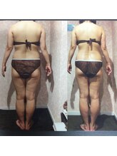 パーフェクトボディプレミアム 大阪梅田店(PERFECT BODY PREMIUM)/お客様　ビフォーアフター（32）