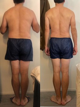 ストーミーストーン(STORMY STONE by Aphros Queen)/やく石浴VIPコース3ヶ月