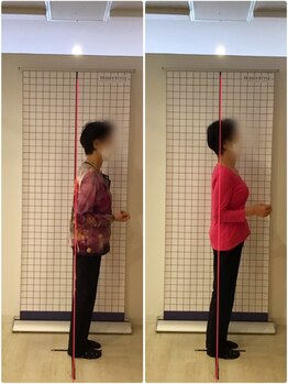 越谷KAJI整体院/肩こり、姿勢改善