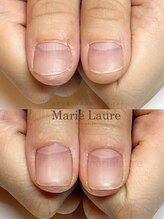 マリーロール 淀屋橋本店(Marie Laure)/自爪育成/深爪矯正/ネイルケア