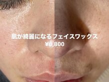 ハリウッドブロウリフト ワクシー 青山店(HOLLYWOOD BROW LIFT WAXYYY.)/毛穴の黒ずみ・産毛・角質除去！