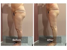 ビューティエン(beauty EN)/痩身ダイエットマッサージエステ