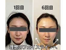 (くいしばり顔の歪み特化)小顔ソムリエ常駐【小顔×整体】