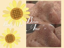 リリーミー(Rily Me)/徹底毛穴洗浄☆