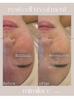 ミミルーチェ(mimiluce)/紫外線ダメージで揺らぐ肌に◎