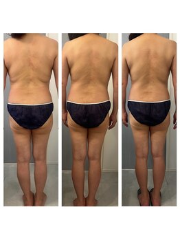 美温(mion)/痩身&コリケア