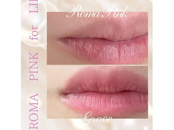 グレイス(Grace)/ローマピンク【唇】