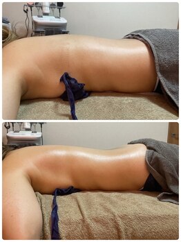 リュミエール(umiere)/1回で変わるボディライン☆