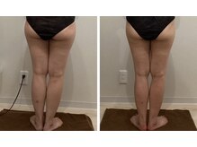 ラナビューティリゾート(Lana Beauty resort)/mayumi★40代・5きろ減