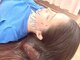 なかの鍼灸整骨院 用勺院の写真/【温灸美容鍼】女性人気No.1の美容鍼灸施術!この時期気になる乾燥肌・シワ・くすみ・たるみを徹底ケア♪