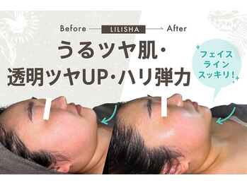 リリーシャ 赤坂(LILISHA)/小顔も美肌もいっぺんに叶う!