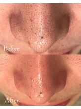 ロイヤルキューティー 介正鍼灸整骨院 コマーシャルモール博多(ROYAL QT)/人気のWAX脱毛