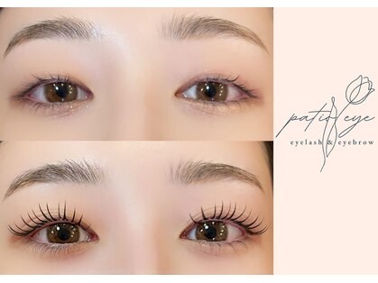 パティオアイ(Patio Eye)の写真