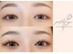 パティオアイ(Patio Eye)の写真