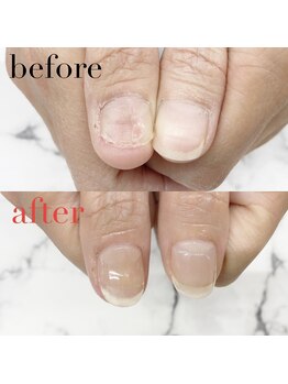 アイネイルズ 布施店(I.NAILS)/深爪/深爪矯正/自爪風ネイル