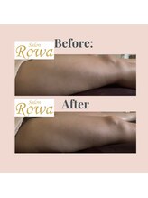 サロン ロワ(Salon Rowa)/痩身機器で頑固な脂肪も撃破！