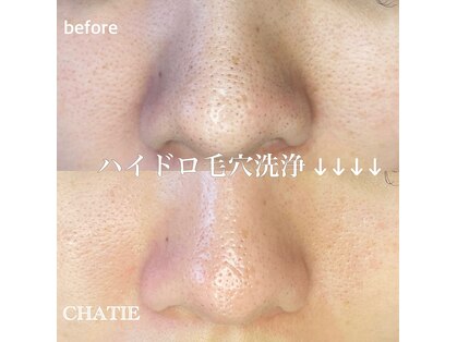 チャティー(CHATIE)の写真
