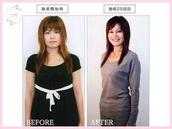 カパリリ/耳つぼ施術☆名古屋/痩身