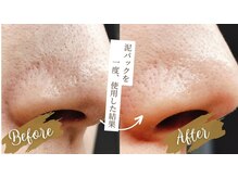 柊の雰囲気（泥パックで毛穴ケア◎一度で毛穴汚れ・詰まりスッキリ改善☆）