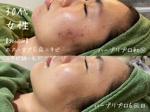 ミコサロン(miko salon)
