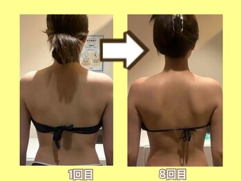 ビオール 池袋店(beall)/大人気!オーダーメイド痩身90分