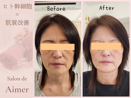 サロン ド エメ(Salon de Aimer)の写真