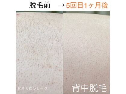 レーヴの写真