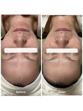 ゆりの花/お肌整え＋シミケア