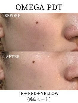 リラ 郡山店(Lilas)/美白モード