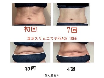 ピースツリー(PEACE TREE)の写真/体重より、体の形を戻したいあなたにも。