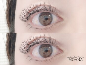 モアナ なんば店(MOANA)/バインドロック100束