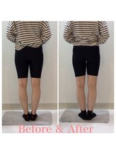 スタイルラボ高松/産後骨盤矯正の効果♪