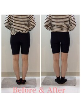 スタイルラボ高松/産後骨盤矯正の効果♪