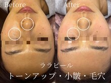 ナスサロ/ララピール