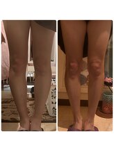 リコ(Relaxation Boutique LICO)/脚もスッキリ！リンパマッサージ