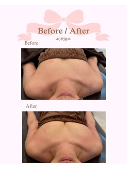 ロココ 安城店(Rococo)/バストアップ症例