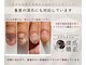 リネイル 川越(Re:NAIL)の写真