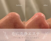 アルテ 神戸(Arte)