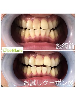 ルブラン 奈良店(Le Blanc)/男性のお客様も気軽に