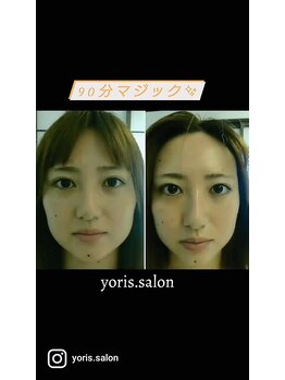 ヨリーズサロン 渡辺通(yoris.salon)/速攻★小顔チェンジ