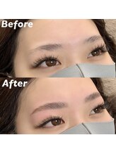 キンキー 広島(kinky)/