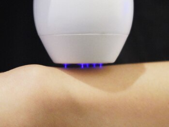 ブルームーン(Blue Moon)/エリア希少『プラズマシャワー』