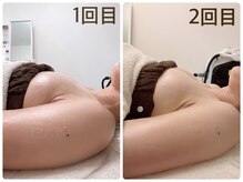 スナグル(Snuggle)/育乳バストアップ♪