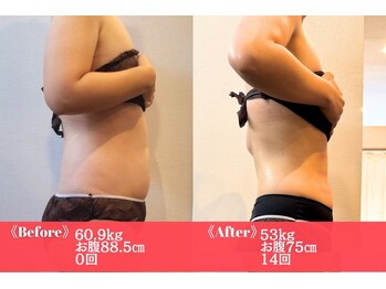 ルフレ(REFLET)/【事例3】Before/After/痩身