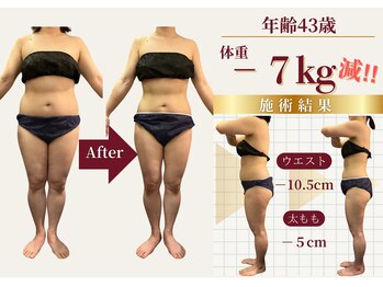 ザ ラウラ ビューティー ボディ(THE LAULA BEAUTY)/43歳【産後太り】