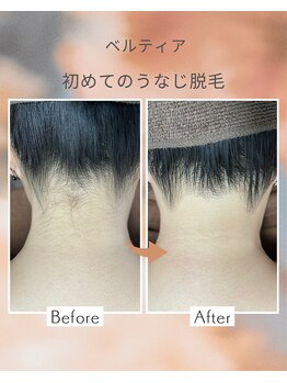 ビューティサロン ベルティア(Beltia)/#脱毛#ダイエット#ブライダル