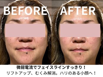 ウルーズ(HRUREUSE)/たった一回でこの変化!