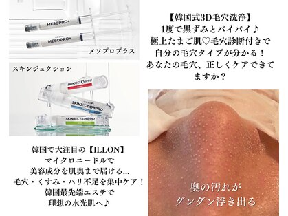 ダイヤモンド リーエンダ(Diamond leende)の写真